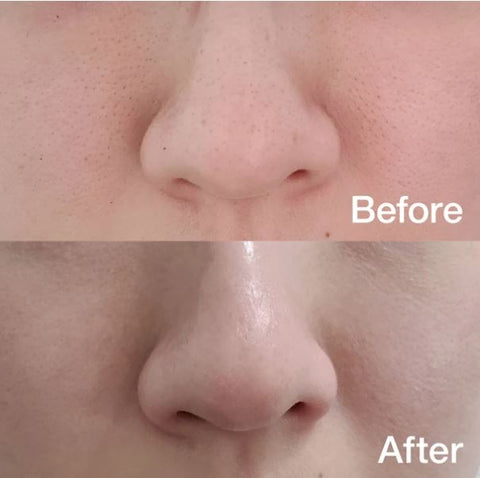 Medicube Zero Pore Pad