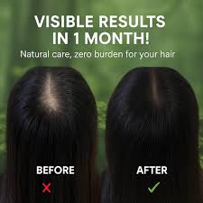 Seven Green Natural Herbal Shampoo Soap – Ultimate Scalp Care & Hair Root